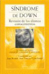 SINDROME DE DOWN. REVISION DE LOS ULTIMOS CONOCIMIENTOS