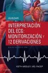 INTERPRETACION DEL ECG MONITORIZACIÓN Y 12 DERIVACIONES