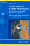 ATLAS DE BOLSILLO DE CORTES ANATÓMICOS TOMO 3 - COLUMNA VERTEBRAL, EXTREMIDADES Y ARTICULACIONES.TOMOGRAFÍA COMPUTARIZADA Y RESONANCIA MAGNÉTICA
